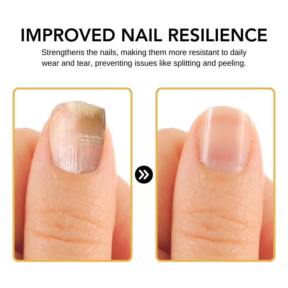 Kolirin BeeVenom Nail Fungus Solution