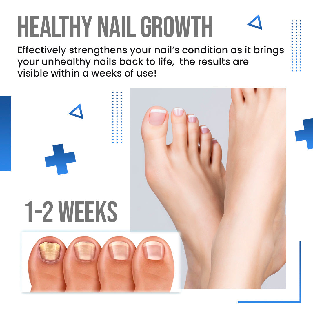 Anti Fungus Blue Light Laser Pen