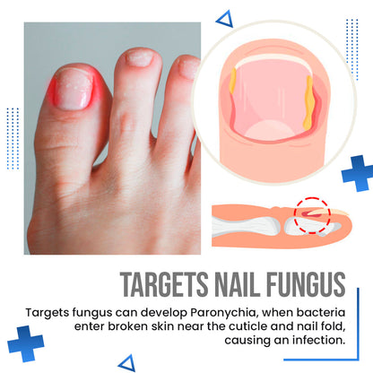 Anti Fungus Blue Light Laser Pen