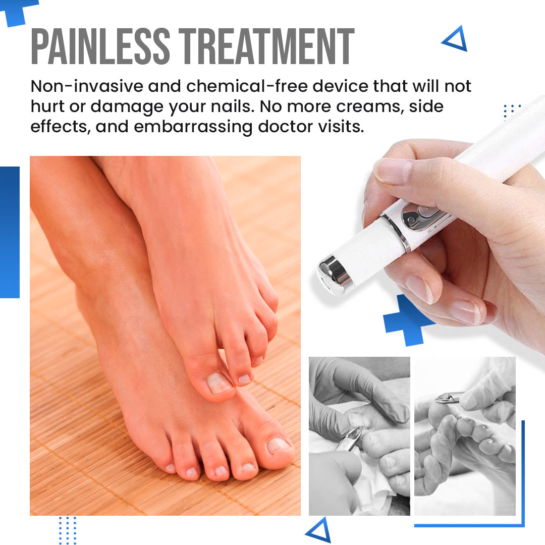 Anti Fungus Blue Light Laser Pen