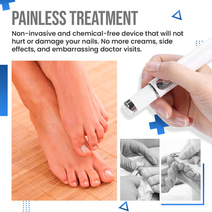 Anti Fungus Blue Light Laser Pen