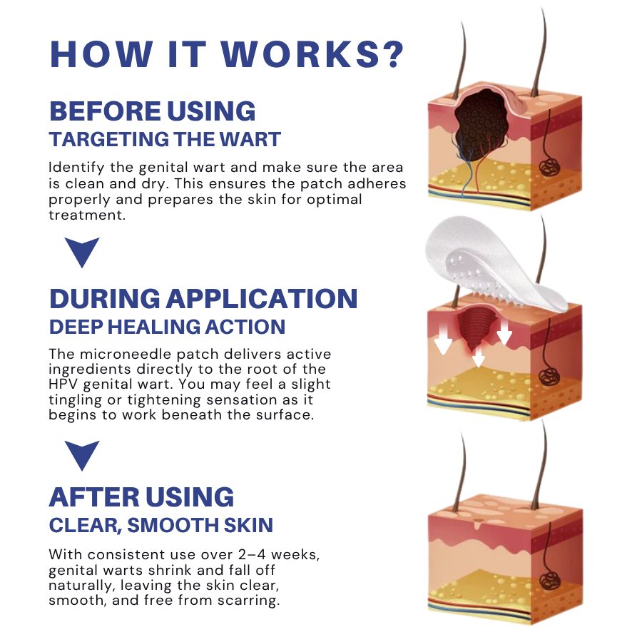 Microneedle HPV Genital Warts Removal Patch