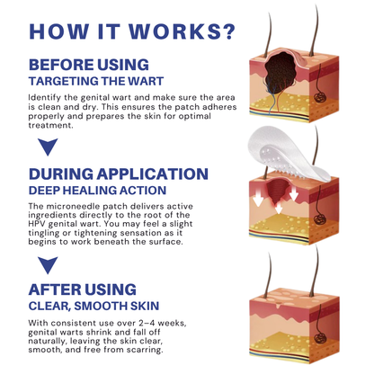 Microneedle HPV Genital Warts Removal Patch