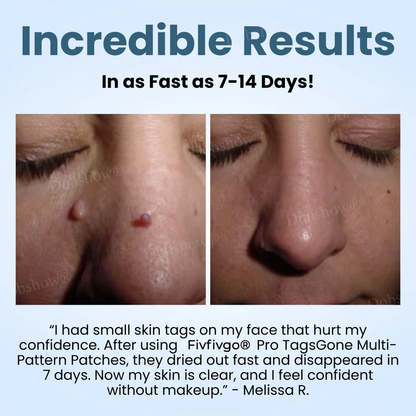 Pro TagsGone Multi-Pattern Patches