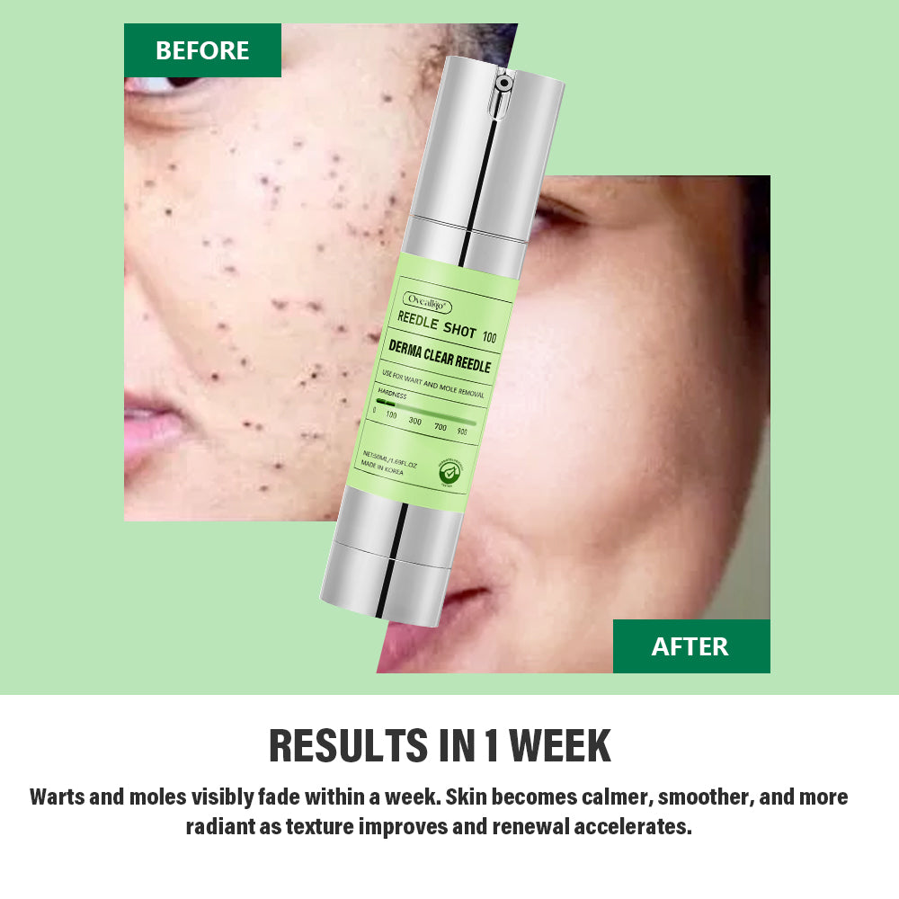 Korean DermaClear Reedle Shot 100 Wart & Mole Eraser Serum