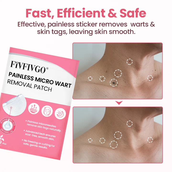 Painless Micro Wart Removal Patch