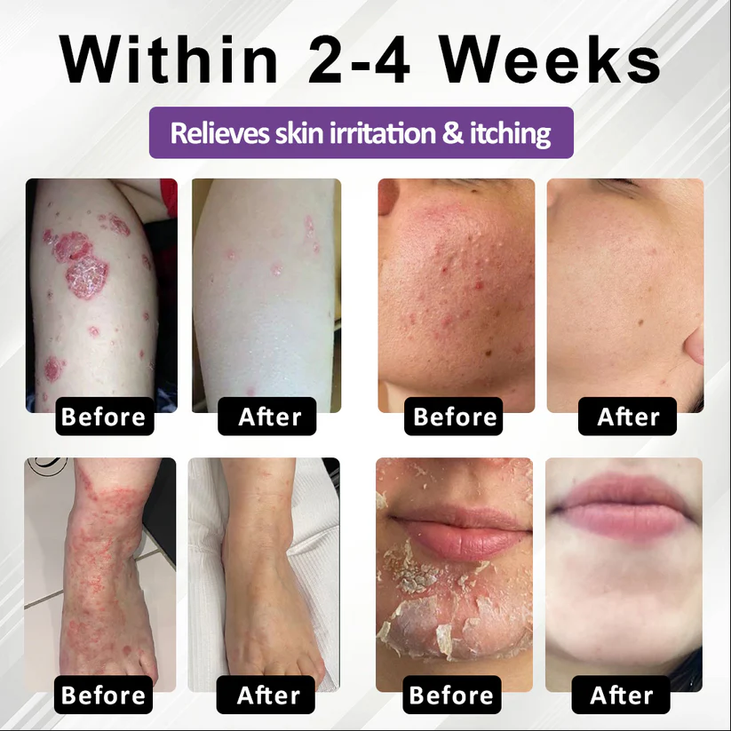 Purple Corn Multi-Condition Skin Spray