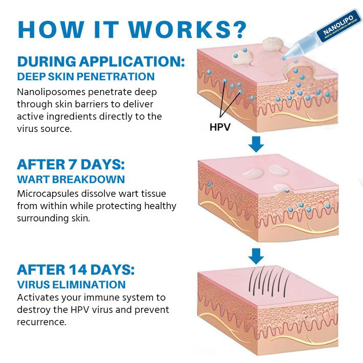 NANOLIPO GENITAL WARTS CLINICAL AMPOULES