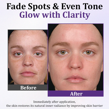 PigmentaX ProFade Anti-Hyperpigmentation Cream