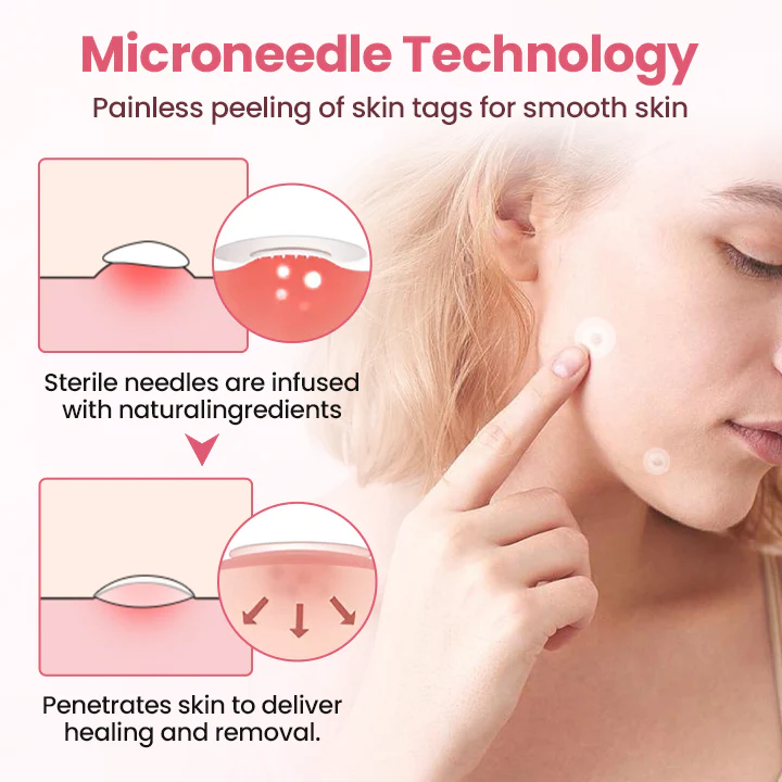 Painless Micro Wart Removal Patch