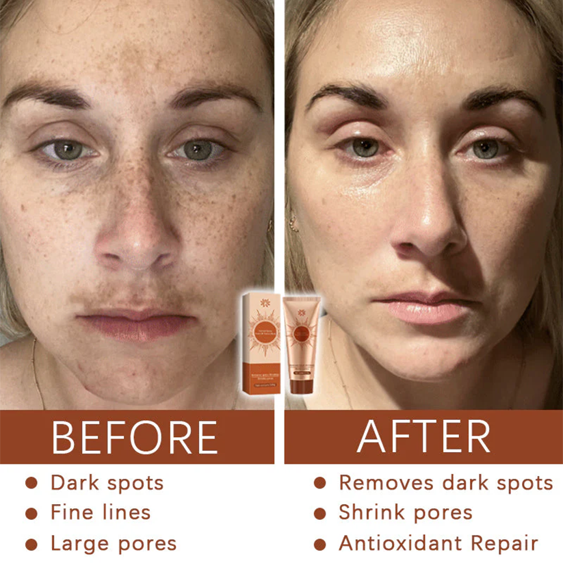 Herbal Spots Peel-Off Facial Mask PRO