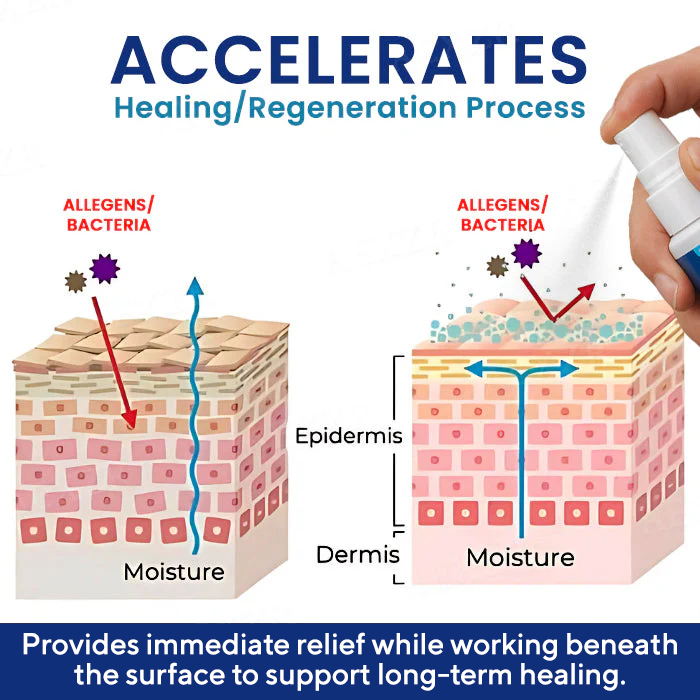 Genital Treatment Spray