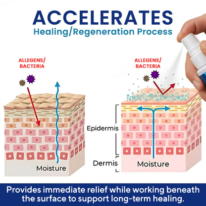 Genital Treatment Spray