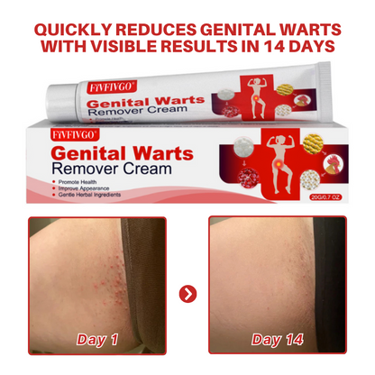 FloraGuard HPV Genital Warts Remover