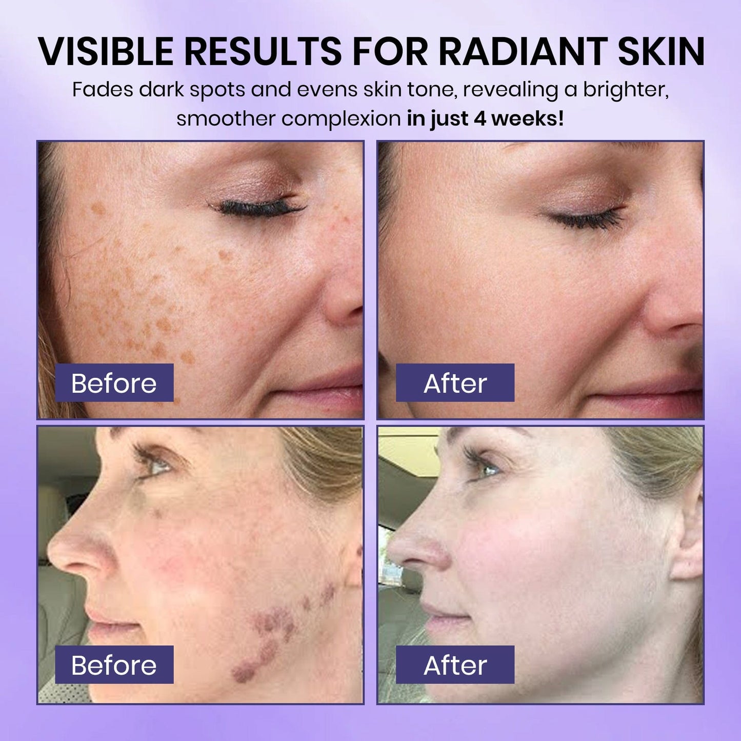 Radiglow Brightening Dark Spot Gel