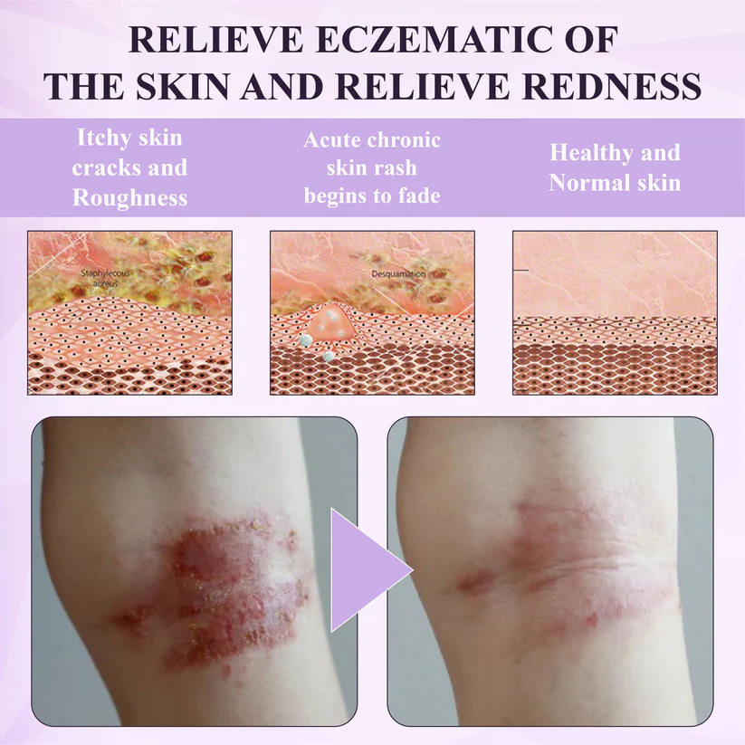 Purple Corn Multi-Condition Skin Spray