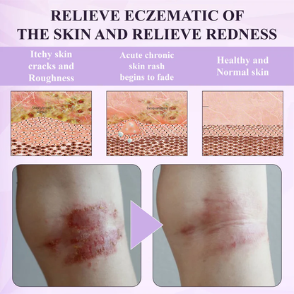 Purple Corn Multi-Condition Skin Spray