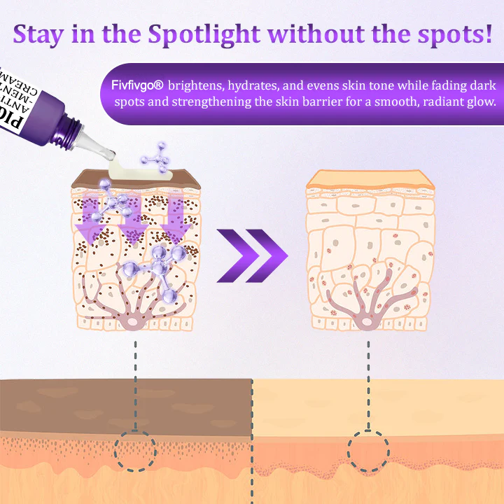 PigmentaX ProFade Anti-Hyperpigmentation Cream