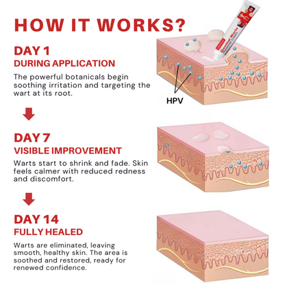 FloraGuard HPV Genital Warts Remover
