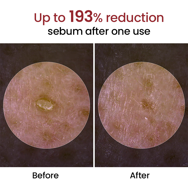 Peel Shot Glow Black Rice Ampoule