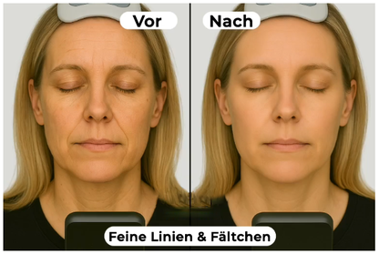 Gefriergetrocknetes Anti-Falten Nano-Seiden-Kollagen