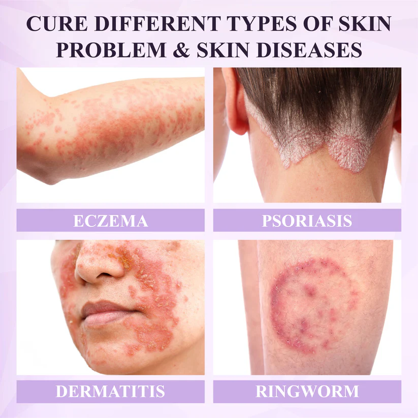 Purple Corn Multi-Condition Skin Spray