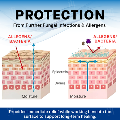 Scrotum Itchy Treatment Cream