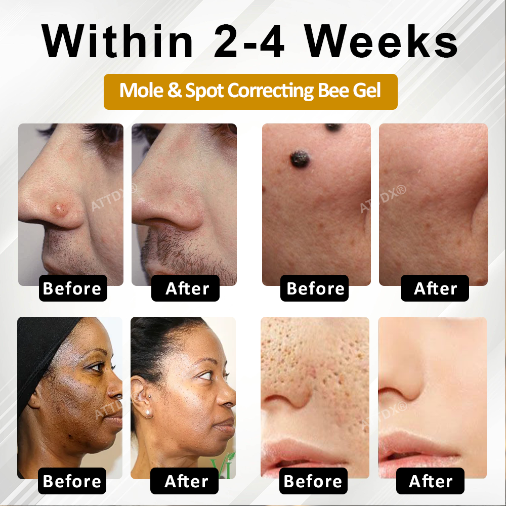 Advanced Mole & Spot Correcting Bee Gel