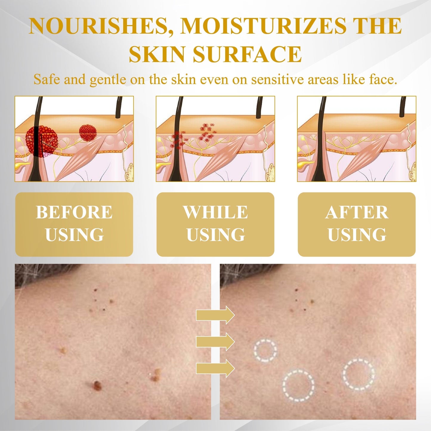 Advanced Mole & Spot Correcting Bee Gel
