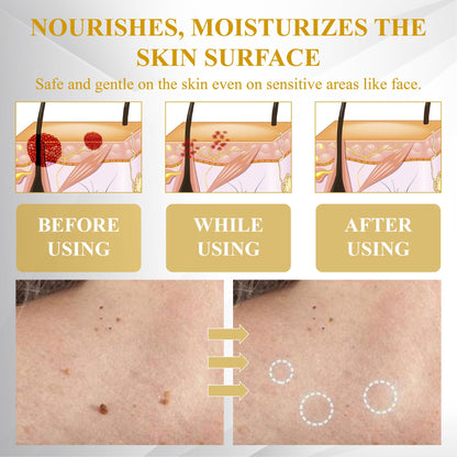 Advanced Mole & Spot Correcting Bee Gel