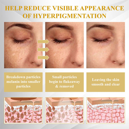 Advanced Mole & Spot Correcting Bee Gel