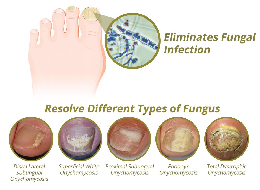 Intense Nail Growth and Strengthening Serum