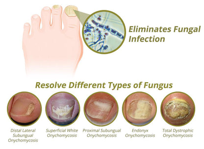 Intense Nail Growth and Strengthening Serum