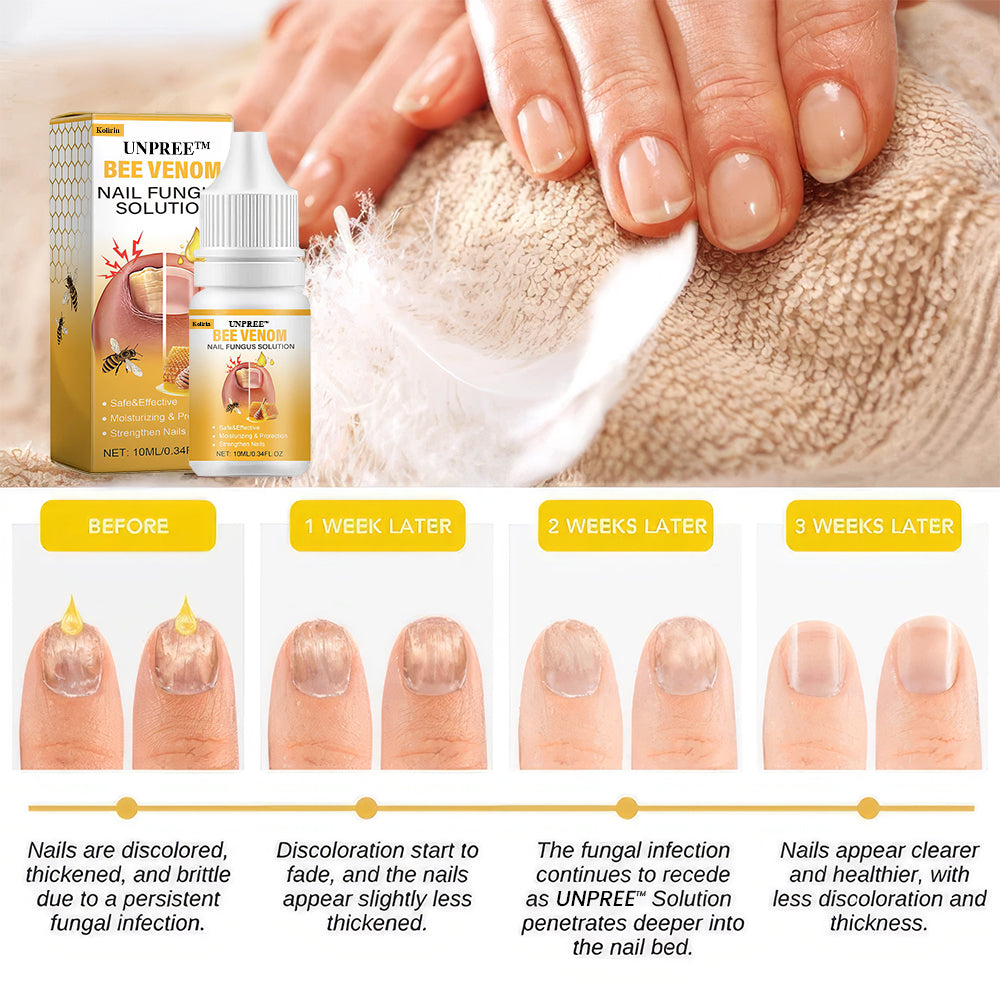 Kolirin BeeVenom Nail Fungus Solution