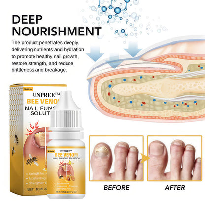 Kolirin BeeVenom Nail Fungus Solution