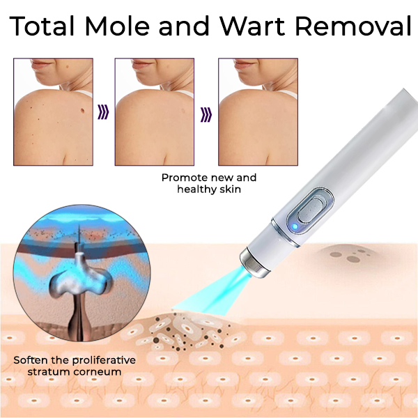 Mole and Wart Removal Laser Set