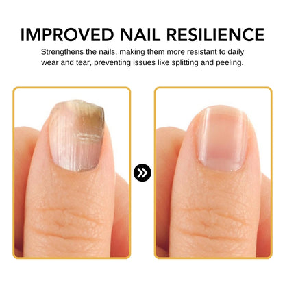 Kolirin BeeVenom Nail Fungus Solution