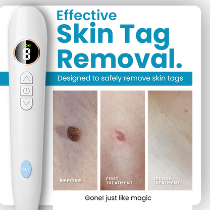 Home Use CO2 Laser Shot Erase Pro