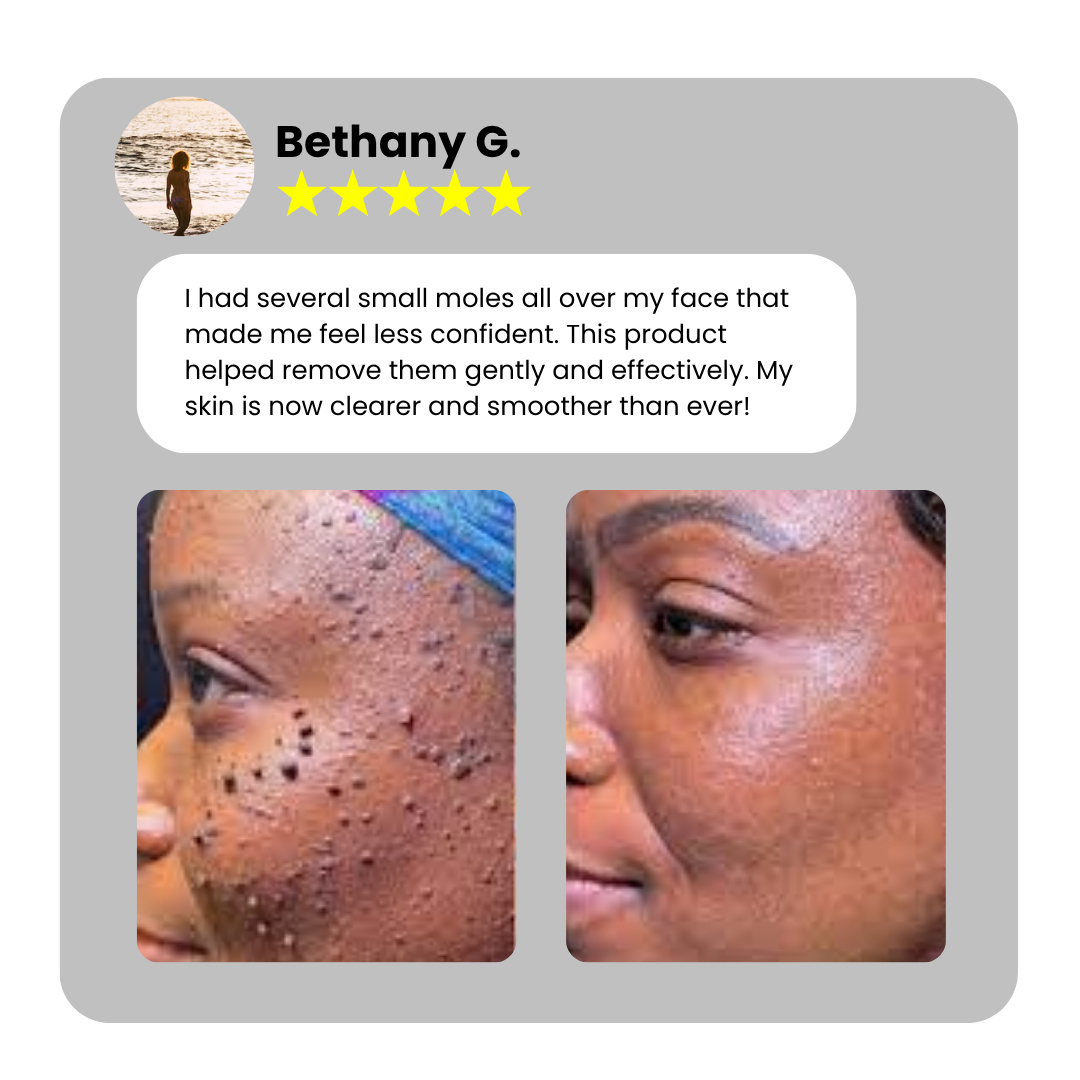 Home Use CO2 Laser Shot Erase Pro