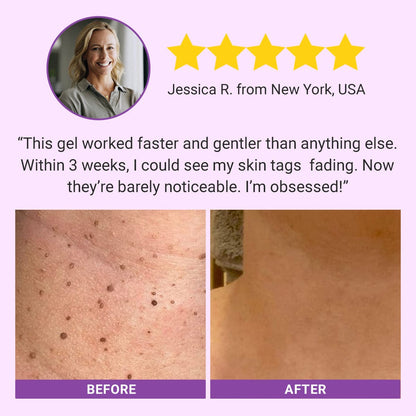 DermaClear Mole and Dark Spot Removal Bio-Gel