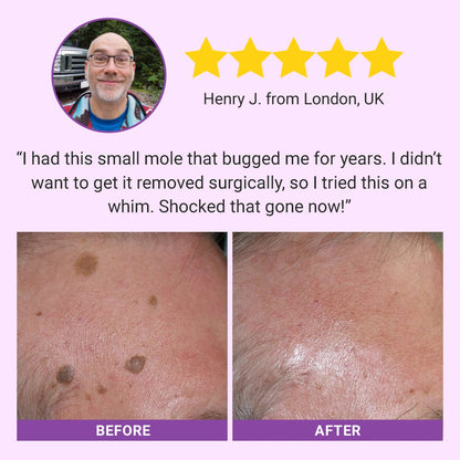 DermaClear Mole and Dark Spot Removal Bio-Gel